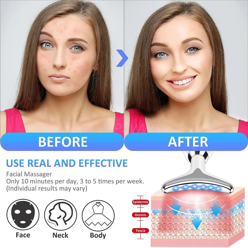 GlowLift™ LED Face Lifting Device